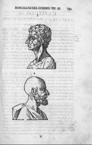 145