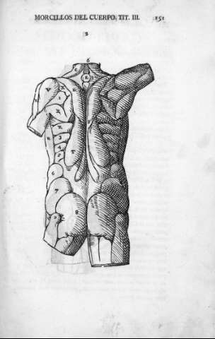 151