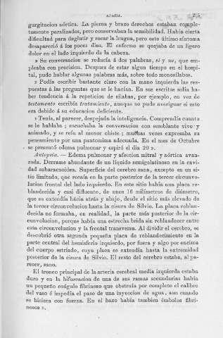215