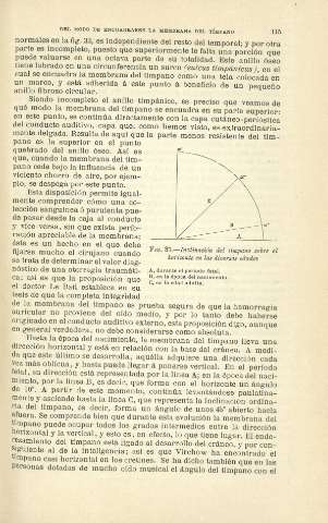 115