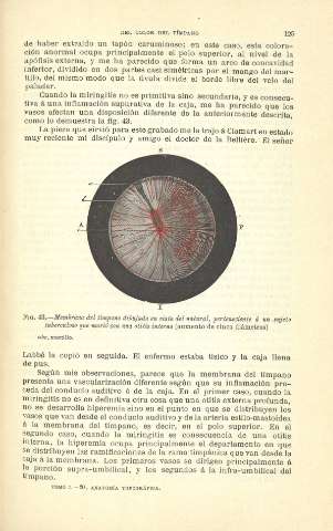 125