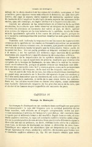151