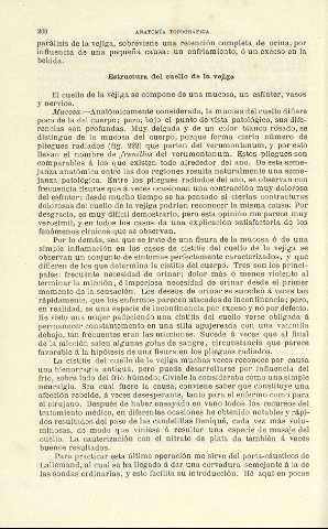 200