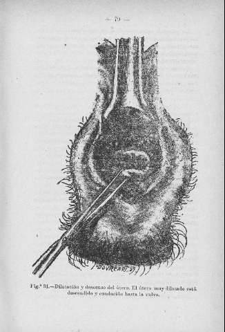 79