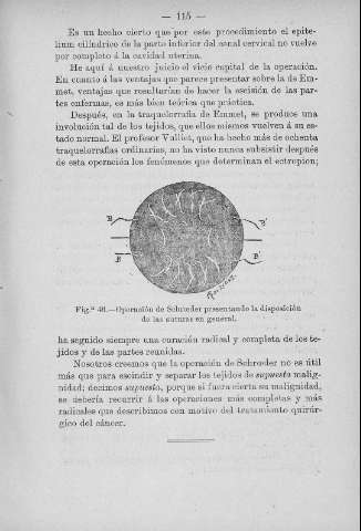 115