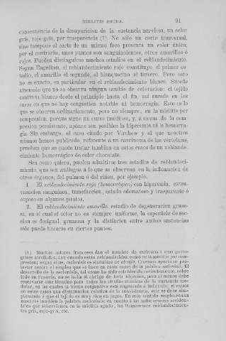91