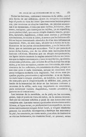 171