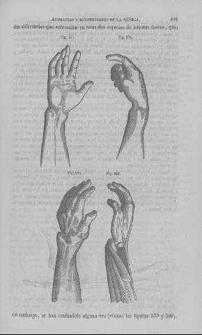 491