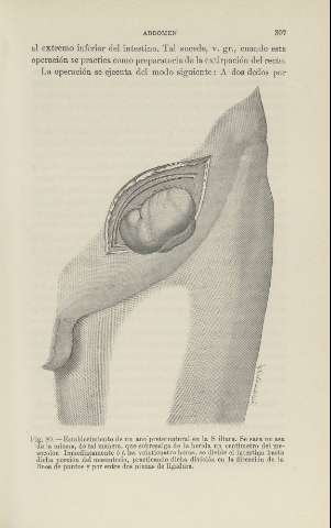 307