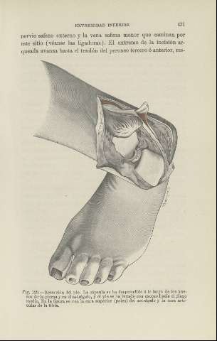 431