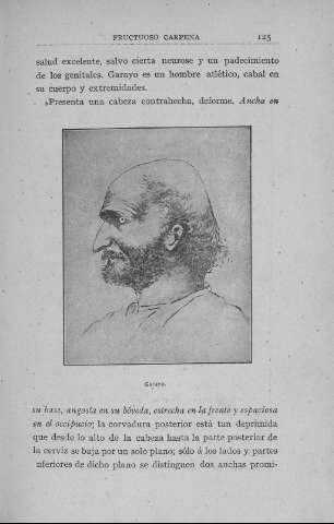 125