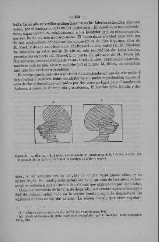 135