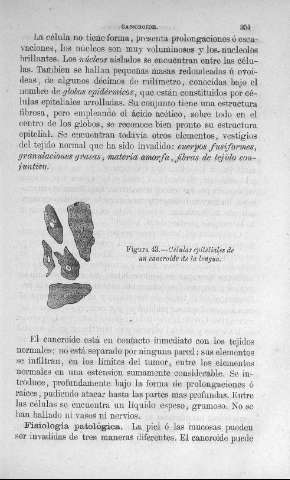 351