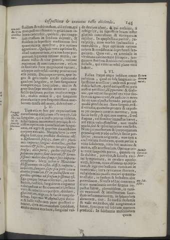 145