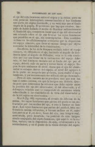70