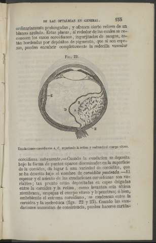 155