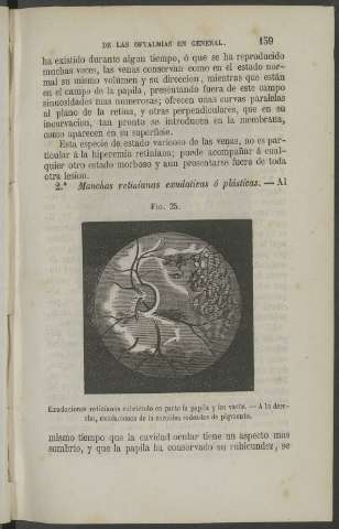159