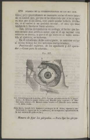 670
