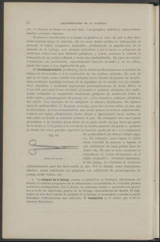 72