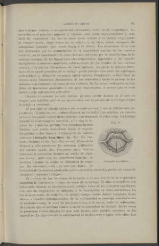 81