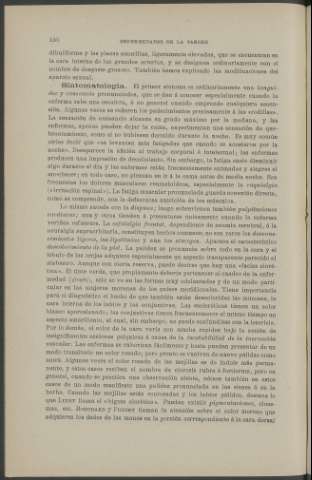 150
