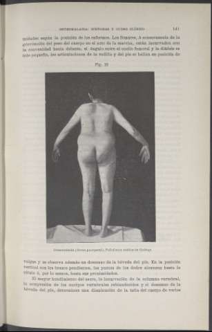 141