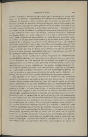 143